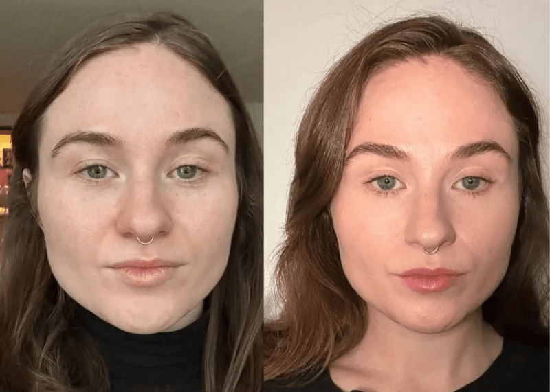 “Buccal Massage” Can Help Contour Your Jawline: Benefits and What to Expect